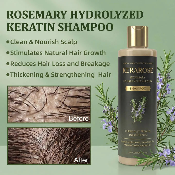 Kerarose™ Rosemary Shampoo