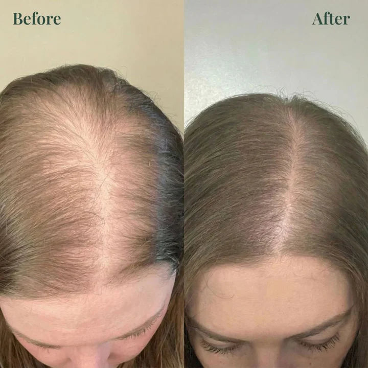 Kerarose™ Rosemary Shampoo