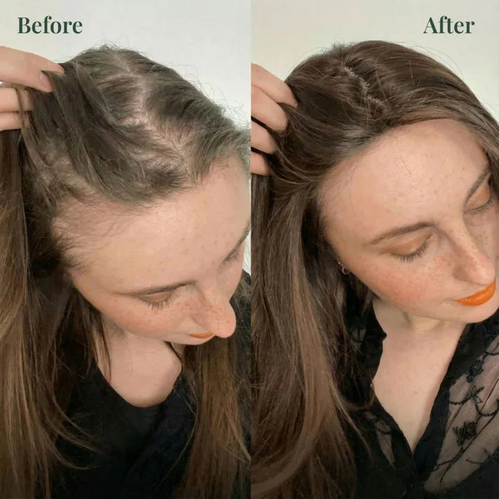 Kerarose™ Rosemary Shampoo